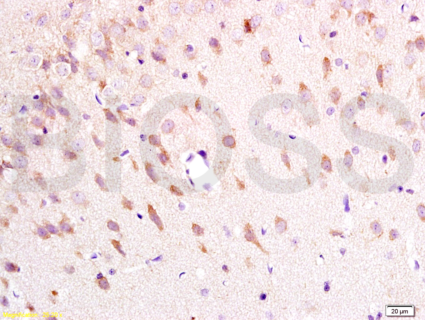 Neurokinin A Receptor Rabbit pAb (一抗) | Bioss