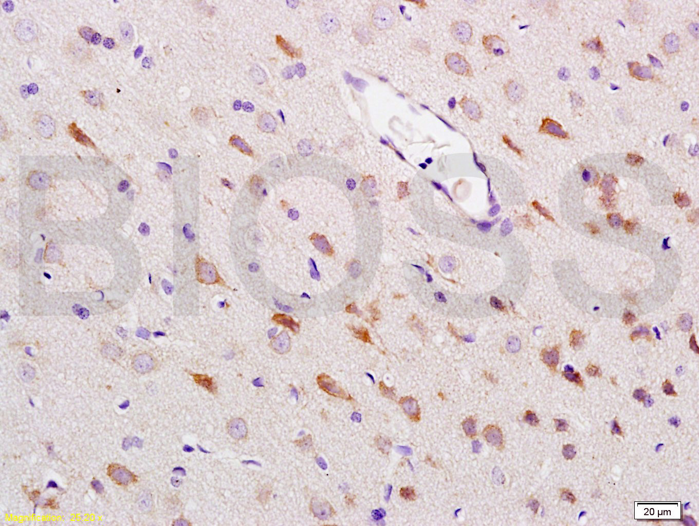 热休克蛋白-70抗体-bs-0126R