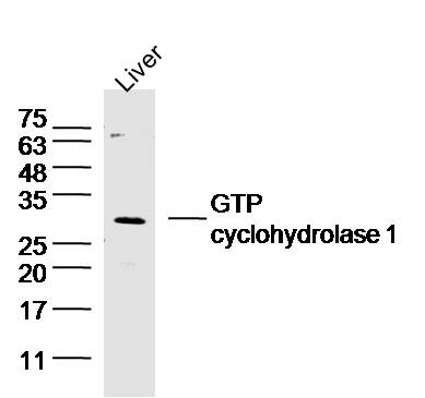 GTP cyclohydrolase 1 Rabbit pAb (一抗) | Bioss