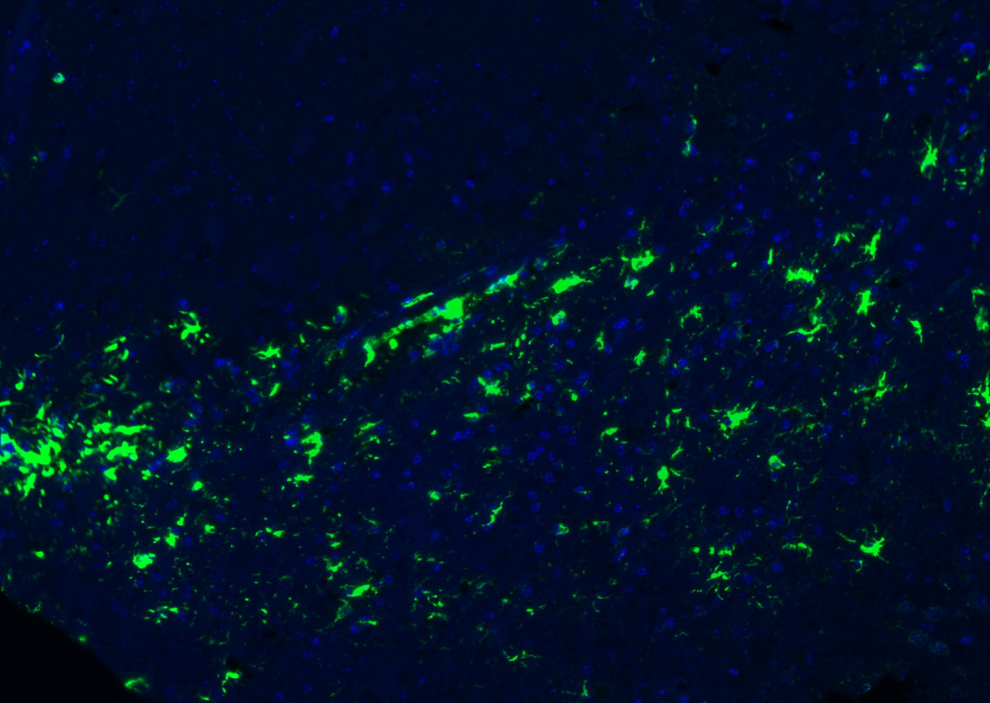 胶质纤维酸性蛋白抗体-bs-0199R