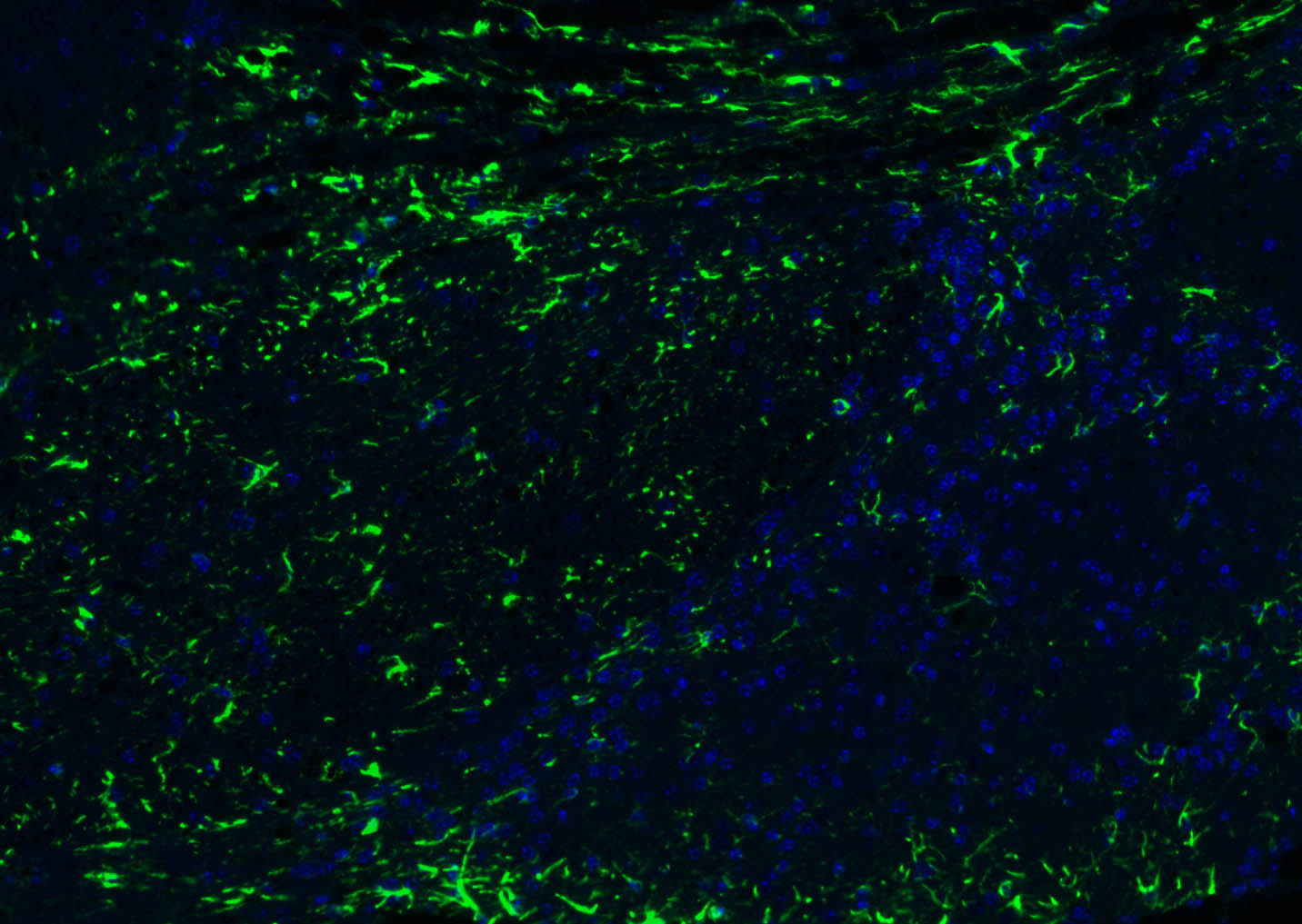 胶质纤维酸性蛋白抗体-bs-0199R