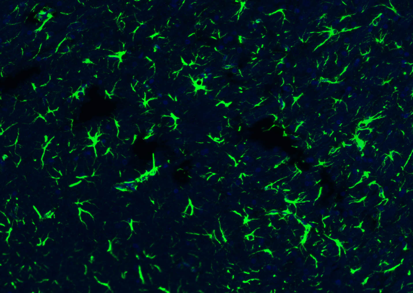 胶质纤维酸性蛋白抗体-bs-0199R
