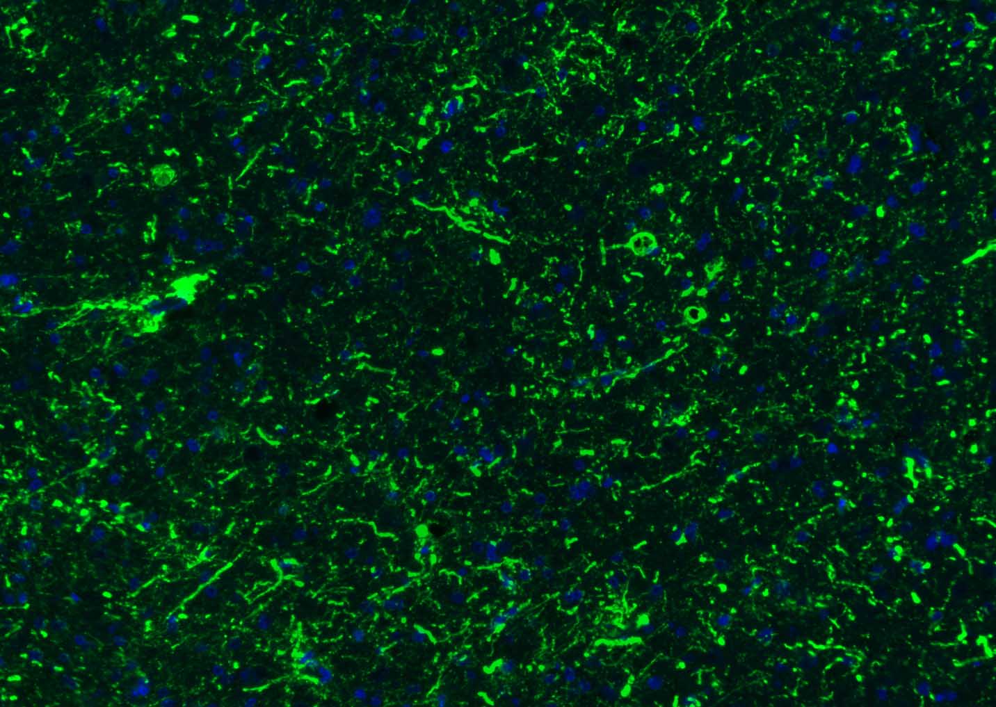 胶质纤维酸性蛋白抗体-bs-0199R