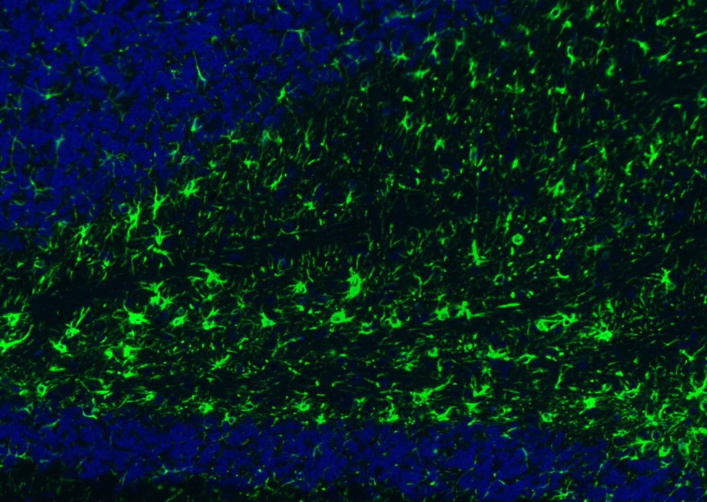 胶质纤维酸性蛋白抗体-bs-0199R