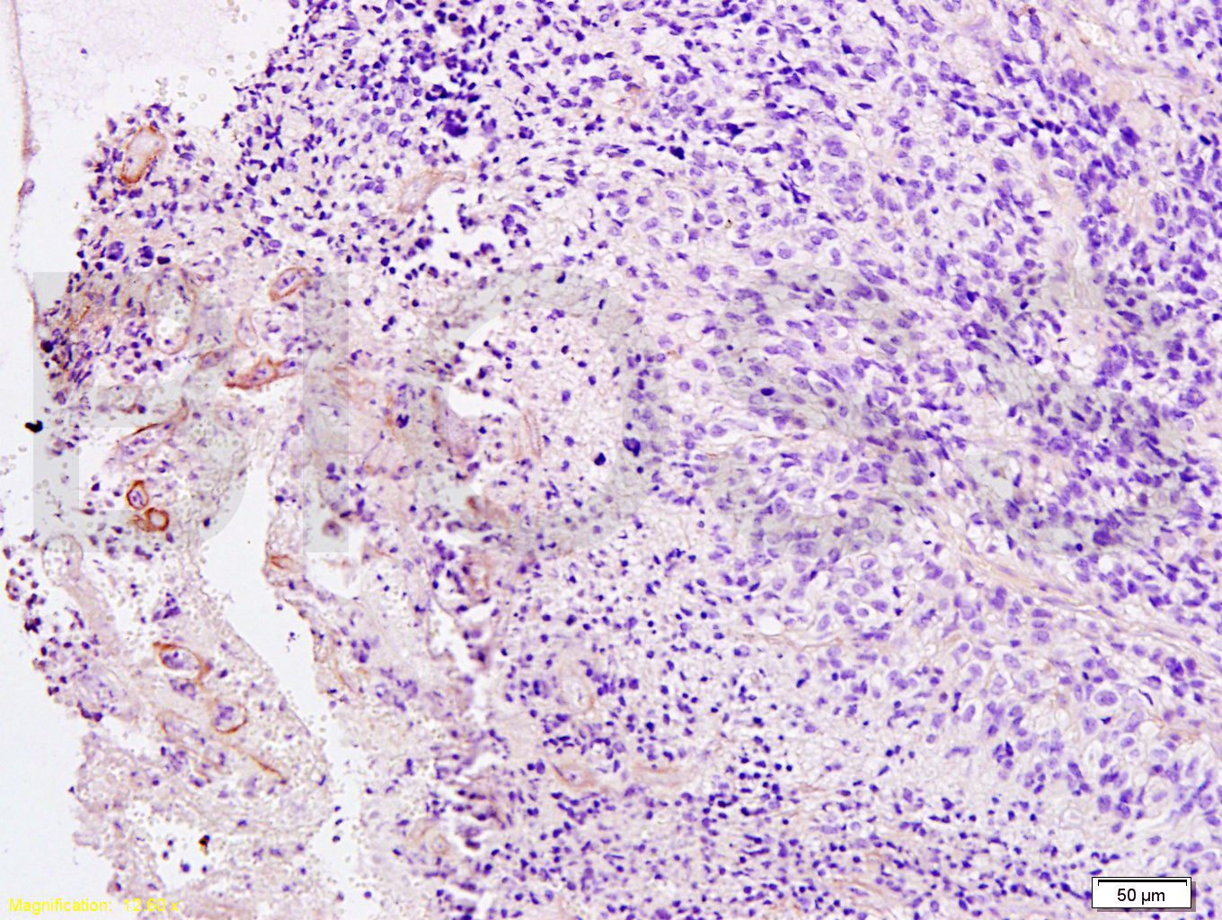 血小板源性生长因子受体B/PDGFRβ抗体-bs-0232R