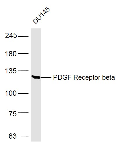 PDGF Receptor beta Rabbit pAb (一抗) | Bioss