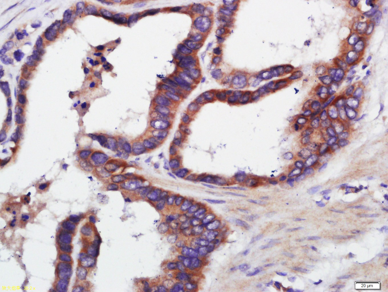 端粒酶反转录酶抗体-bs-0233R
