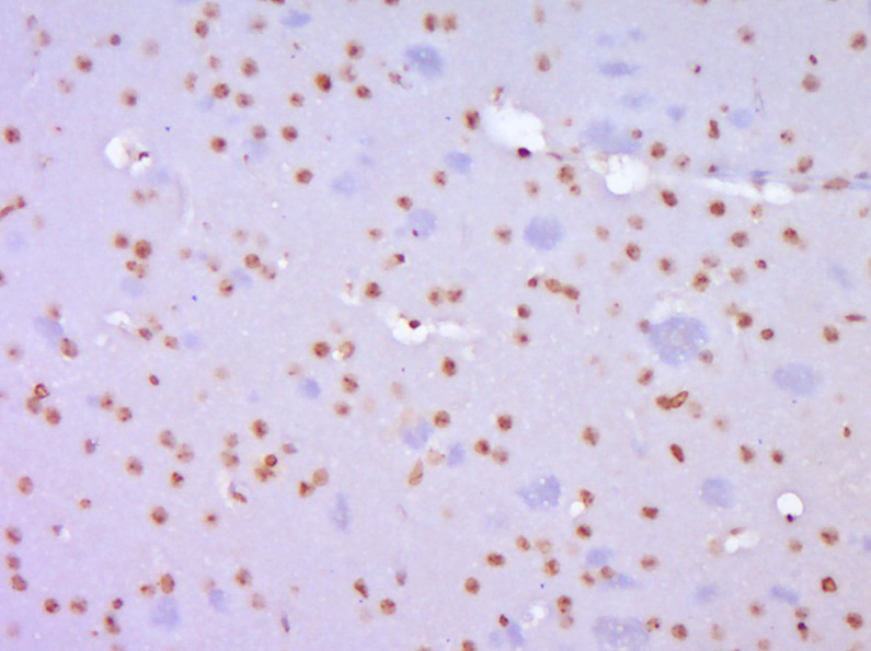 端粒酶反转录酶抗体-bs-0233R