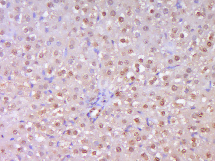 端粒酶反转录酶抗体-bs-0233R