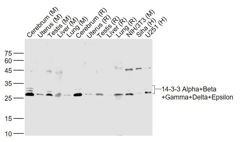 14-3-3 Alpha + Beta + Gamma + Delta + Epsilon Rabbit pAb (一抗) | Bioss