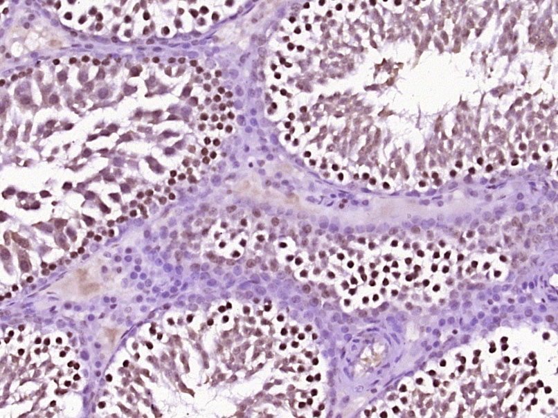 热休克蛋白70抗体-bs-0244R