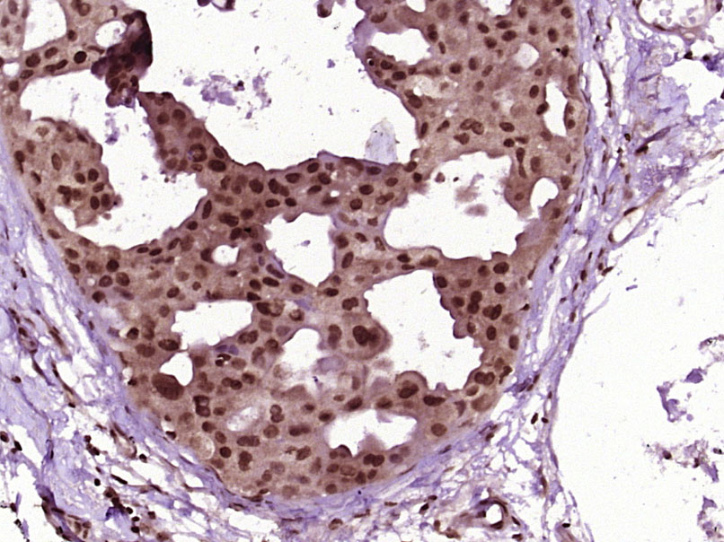 热休克蛋白70抗体-bs-0244R