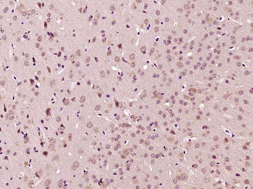 Glucocorticoid receptor Rabbit pAb (一抗) | Bioss