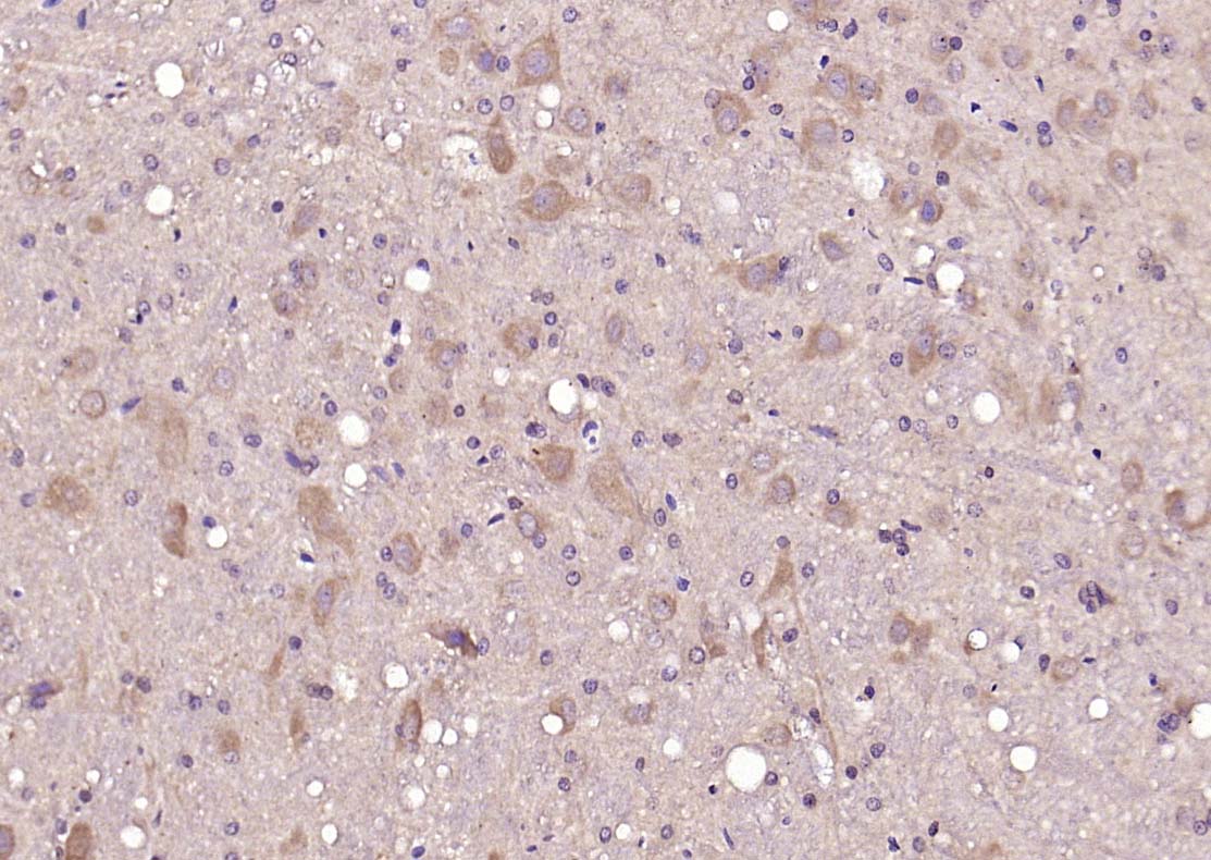 糖皮质激素受体抗体-bs-0252R