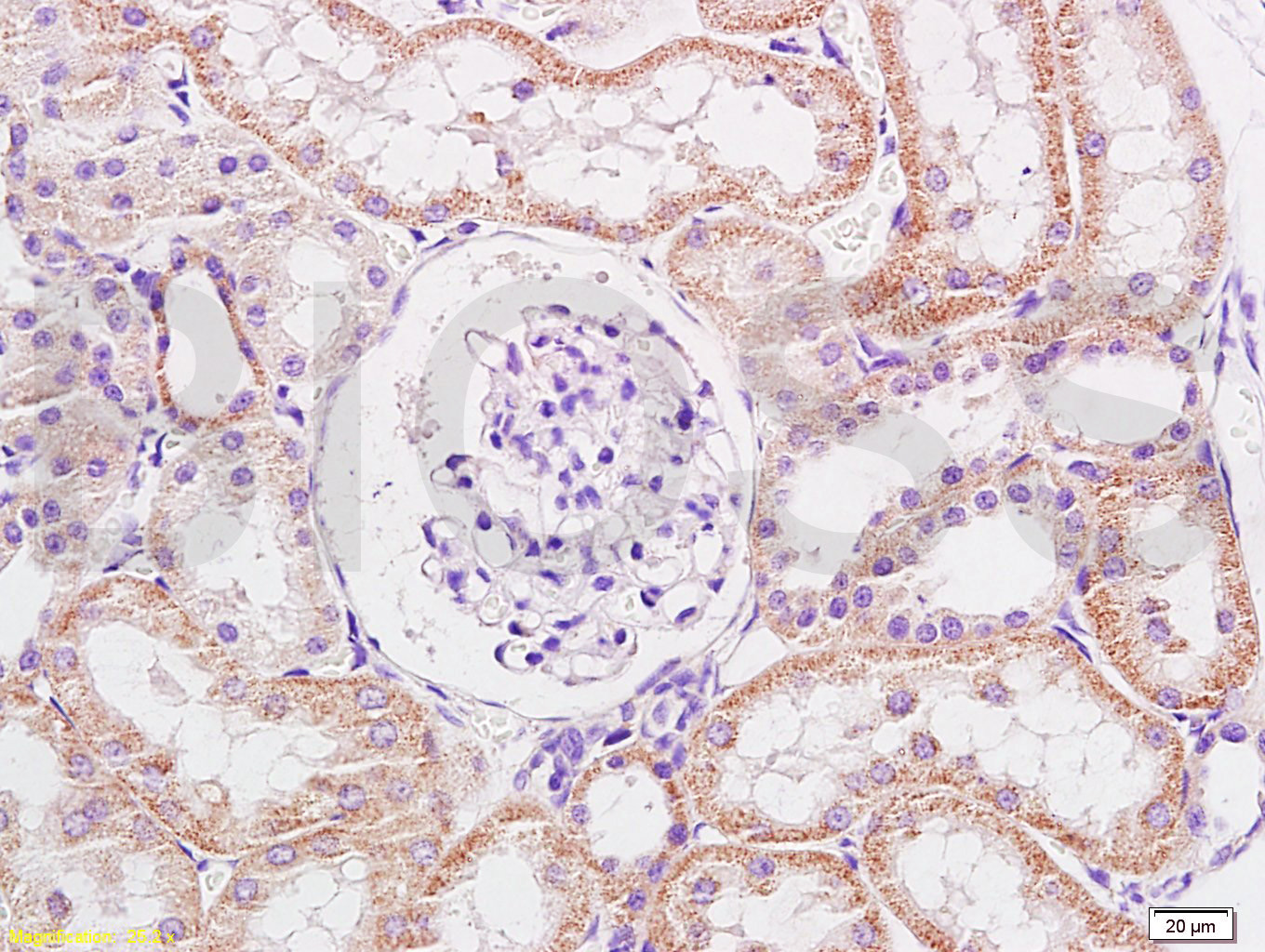 心肌肌球蛋白重链抗体