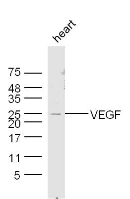 VEGFA Rabbit pAb (一抗) - WB | Bioss