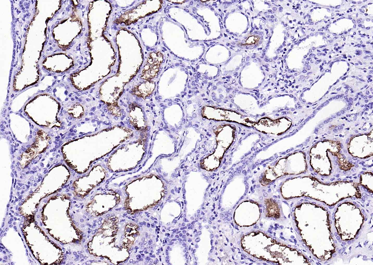 辣根过氧化物酶标记的羊抗兔IgG H&L