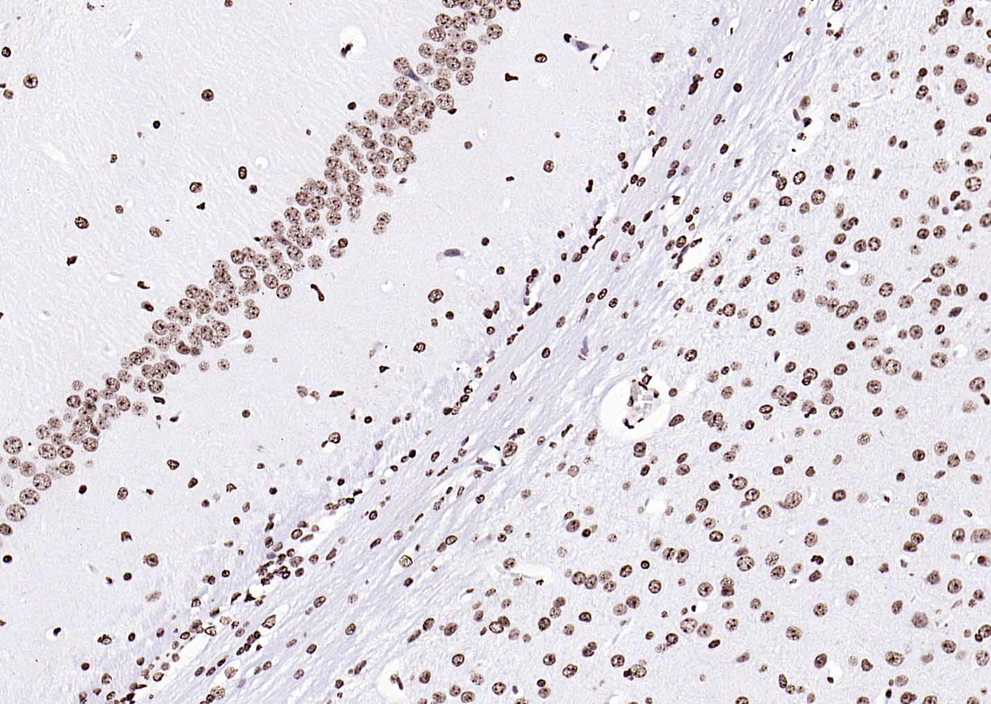 辣根过氧化物酶标记的羊抗兔IgG H&L