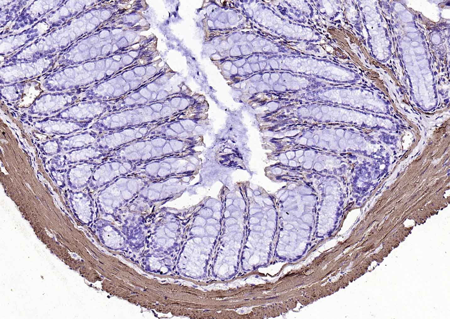辣根过氧化物酶标记的羊抗小鼠IgG H&L