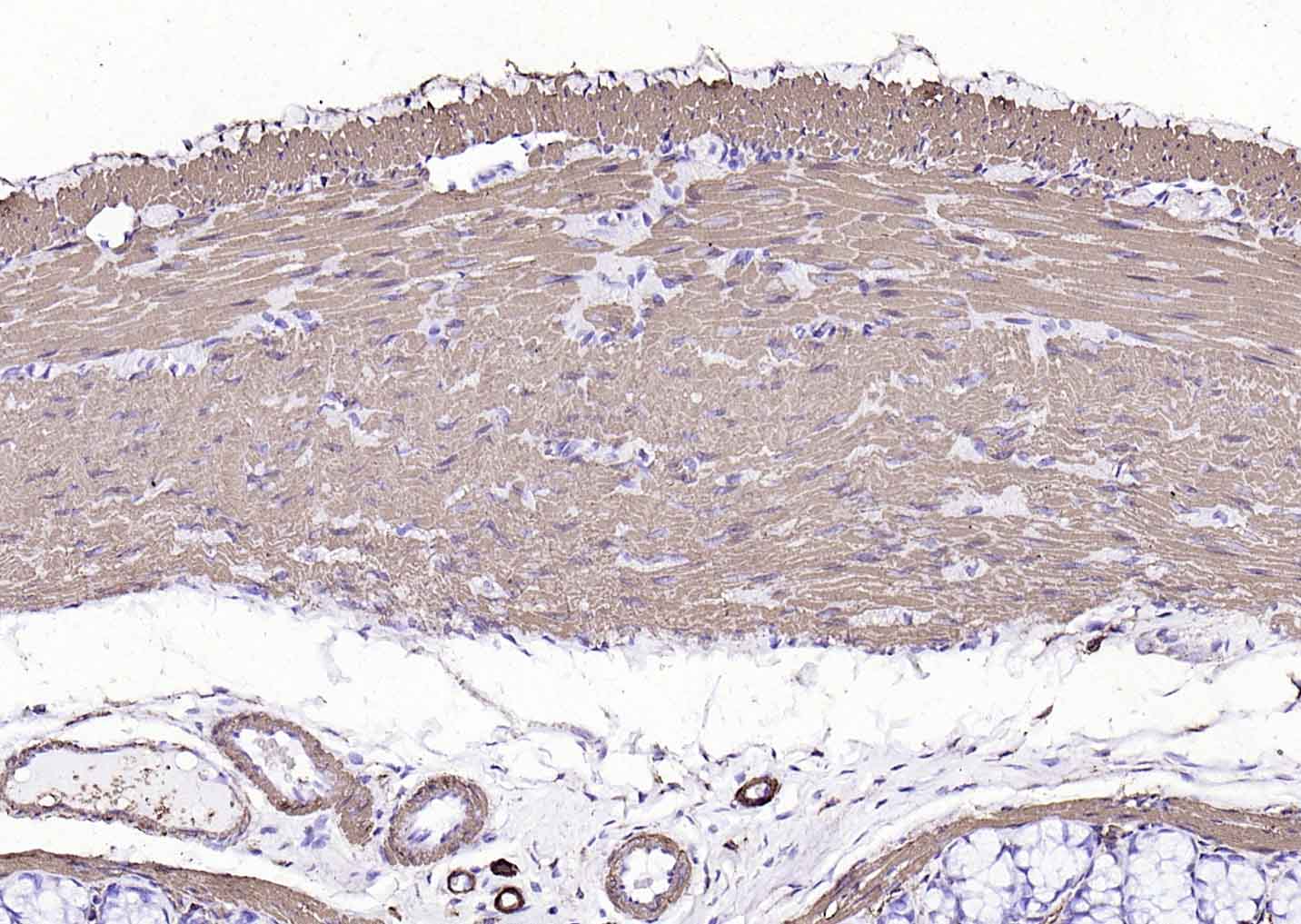 辣根过氧化物酶标记的羊抗小鼠IgG H&L