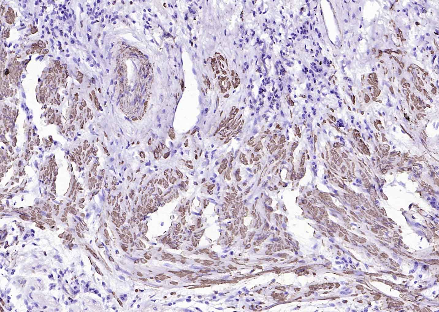 辣根过氧化物酶标记的羊抗小鼠IgG H&L