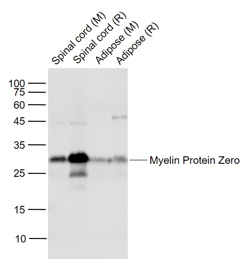 Myelin Protein Zero Rabbit pAb (一抗) - WB | Bioss