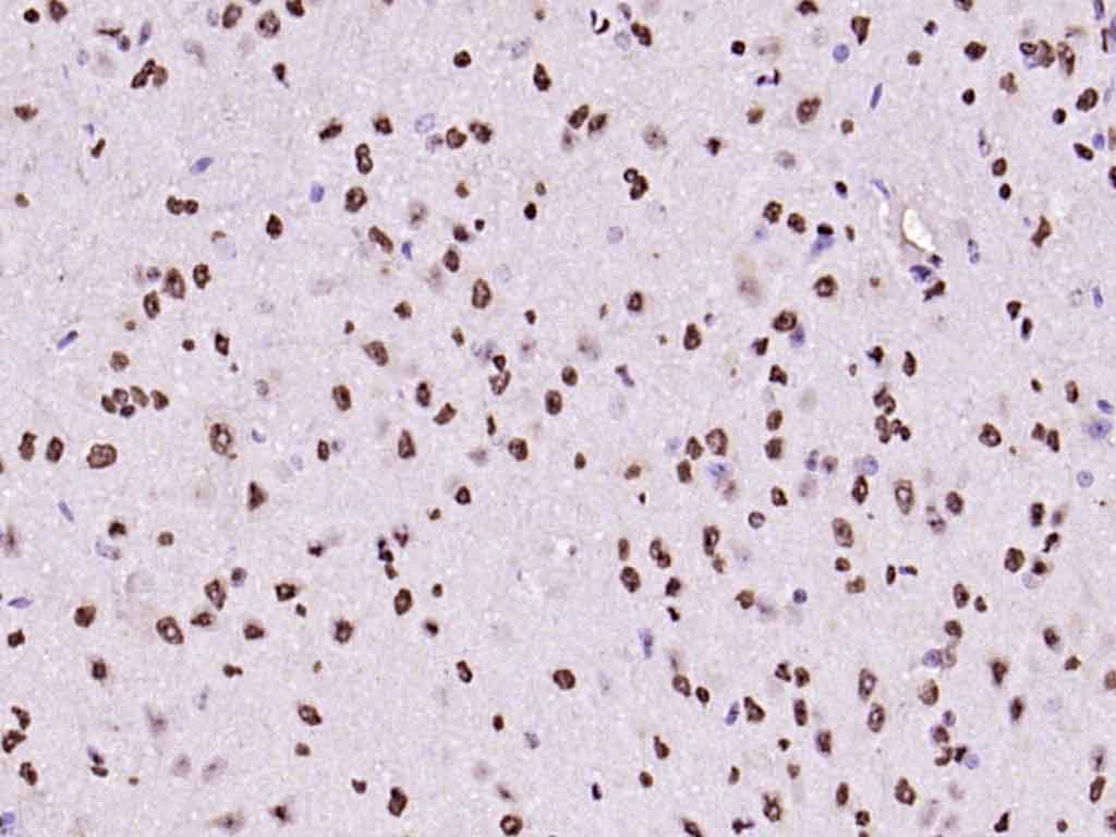 组蛋白H3（核内参）抗体-bs-0349R