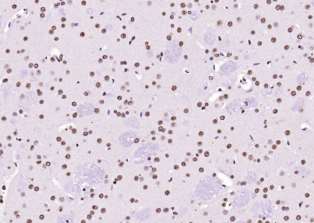 组蛋白H3（核内参）抗体-bs-0349R