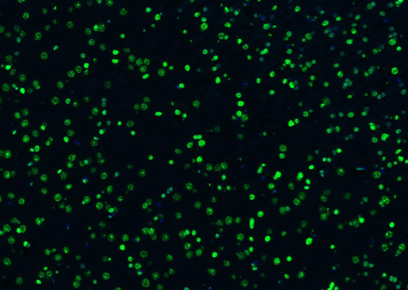 组蛋白H3（核内参）抗体-bs-0349R