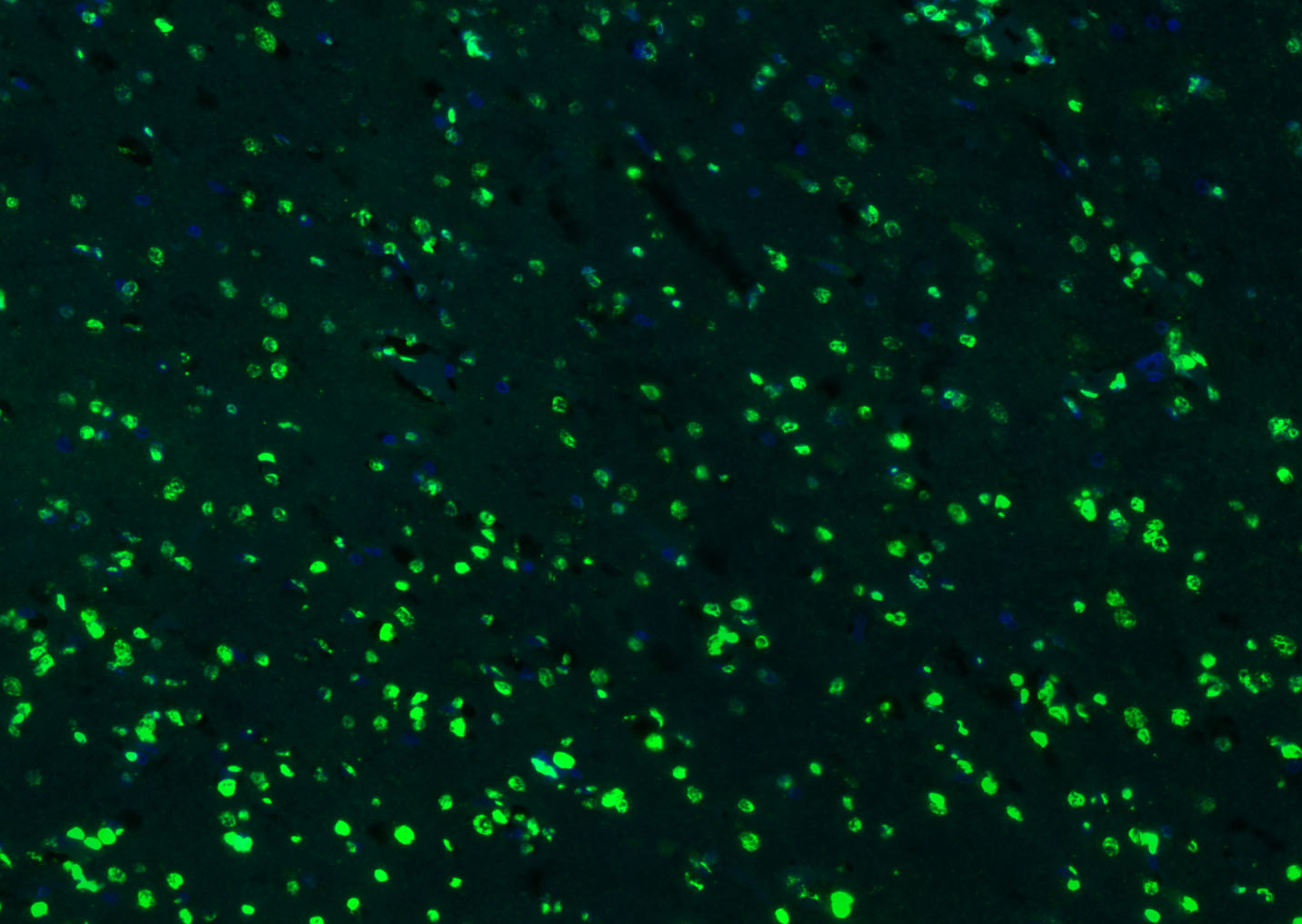 组蛋白H3（核内参）抗体-bs-0349R