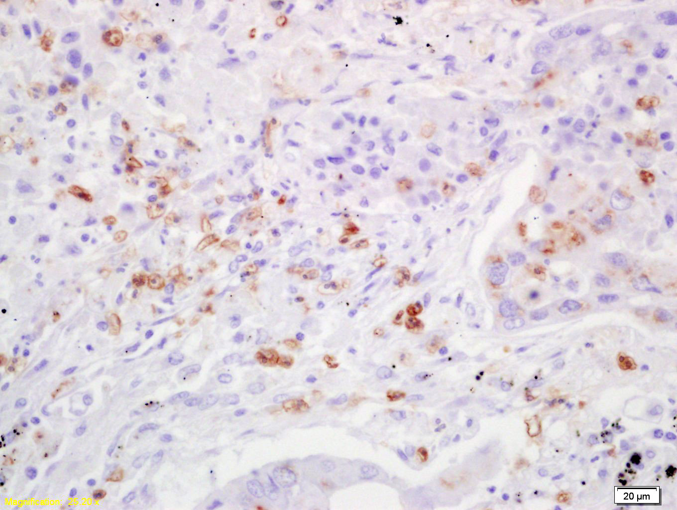 TIMP-3 Rabbit pAb (一抗) | Bioss