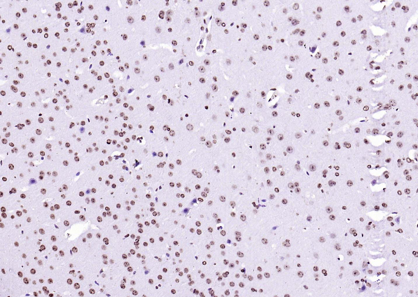 辣根过氧化物酶标记链霉亲和素-bs-0437P-HRP