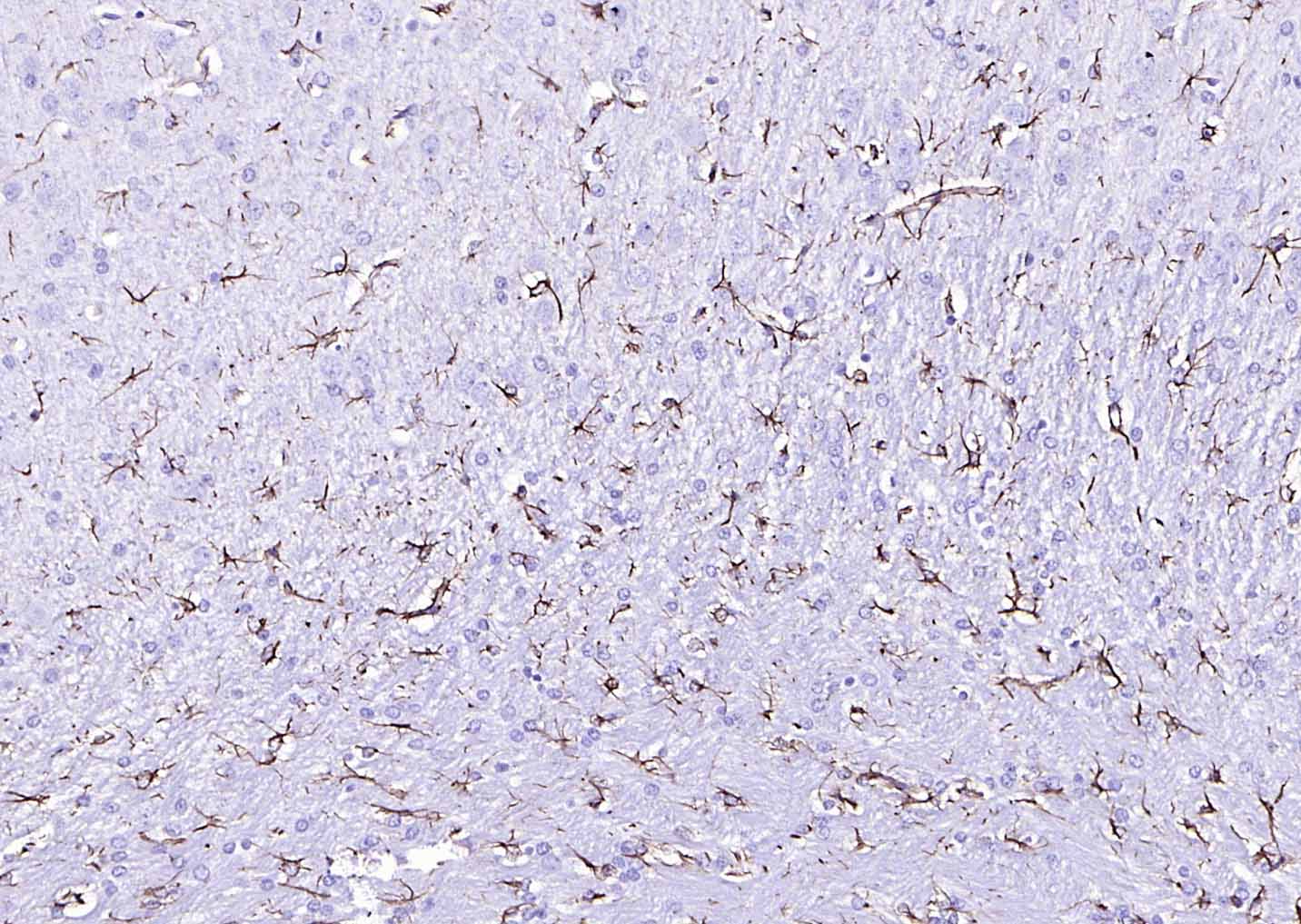 辣根过氧化物酶标记链霉亲和素-bs-0437P-HRP