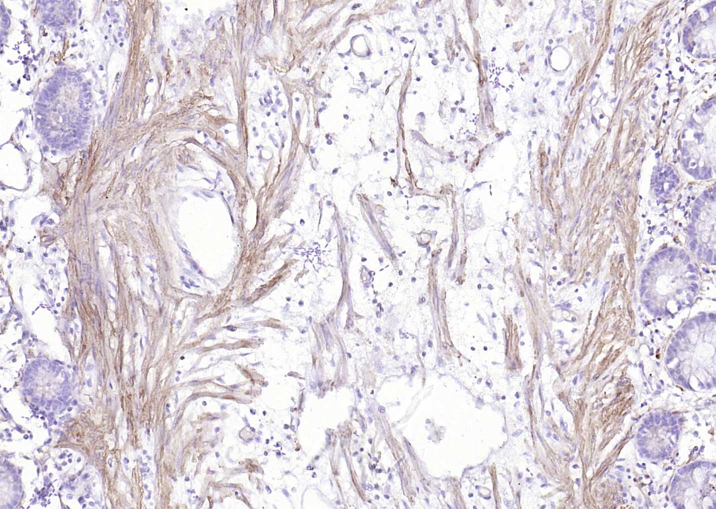 辣根过氧化物酶标记链霉亲和素-bs-0437P-HRP