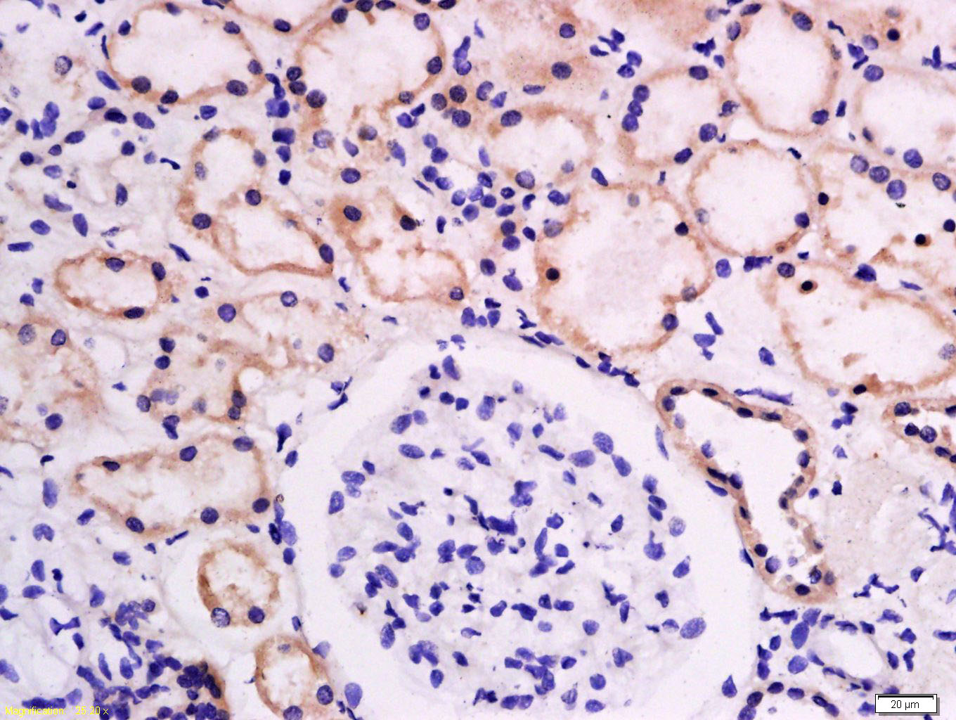 葡萄糖转运蛋白1抗体
