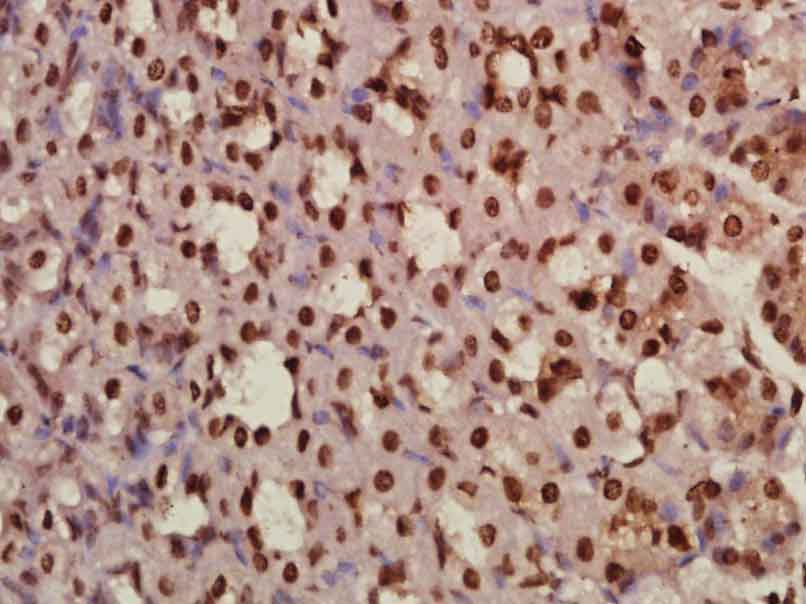 周期蛋白依赖激酶抑制因子1C抗体-bs-0538R