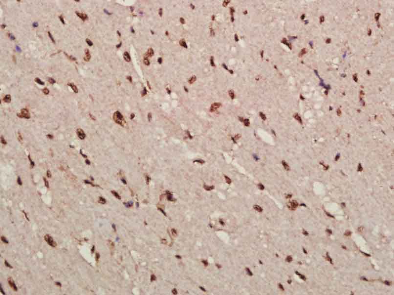 周期蛋白依赖激酶抑制因子1C抗体-bs-0538R