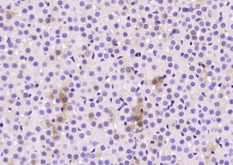 嗜铬粒素A抗体-bs-0539R