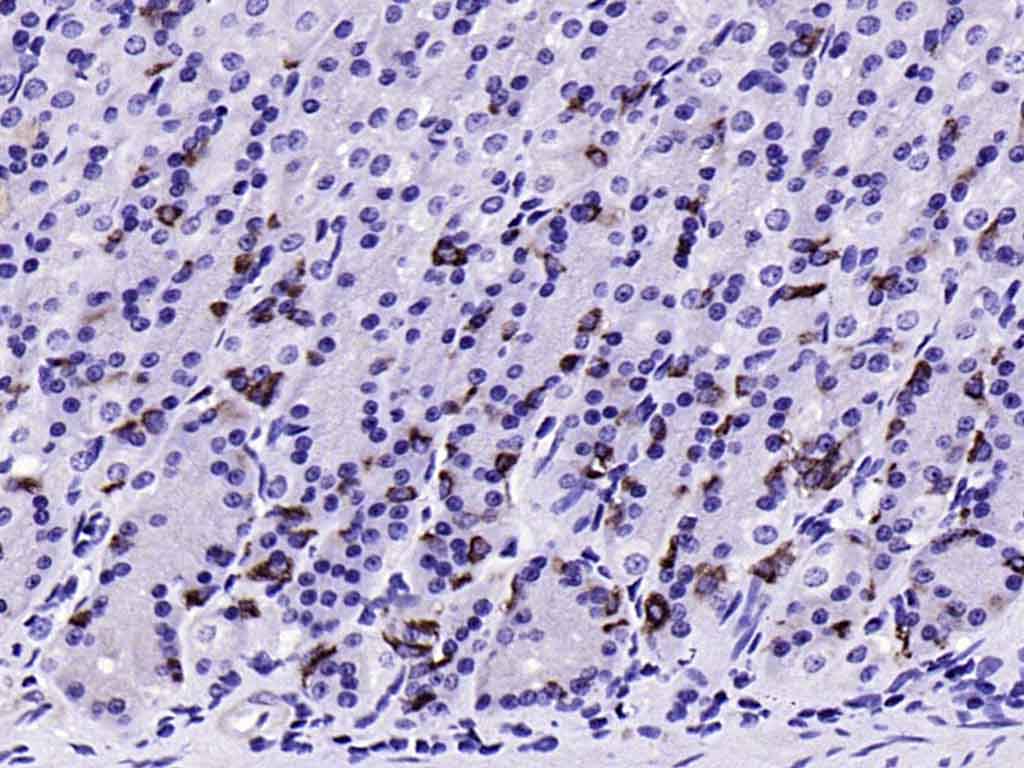 CHGA Rabbit pAb (一抗) - IHC-P,IHC-F,IF,ICC/IF | Bioss