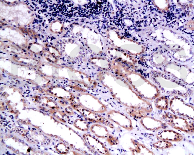 内皮抑素/内皮他丁抗体-bs-0547R