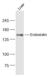 Endostatin Rabbit pAb (一抗) | Bioss