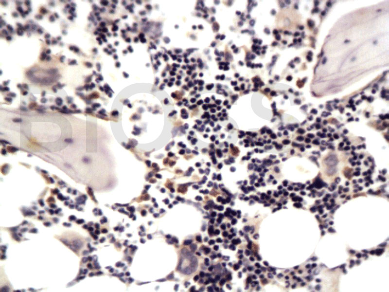 基质金属蛋白酶13抗体-bs-0575R