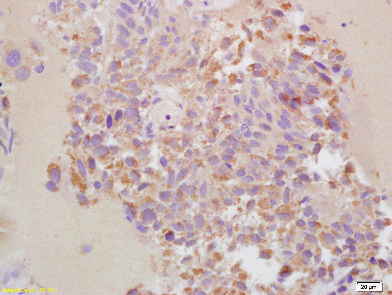 基质金属蛋白酶13抗体-bs-0575R