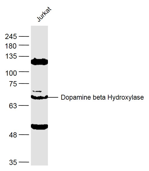 Dopamine beta Hydroxylase Rabbit pAb (一抗) | Bioss