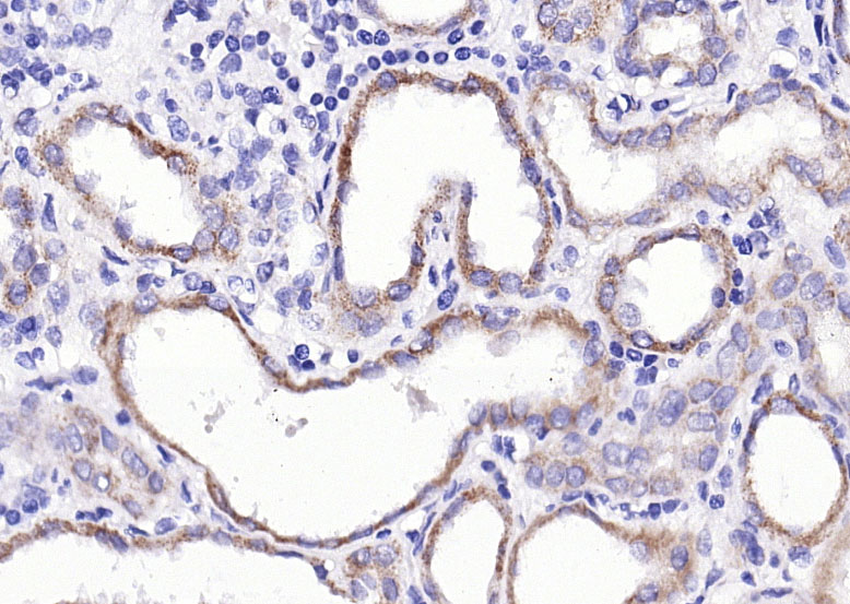 水通道蛋白4抗体-bs-0634R