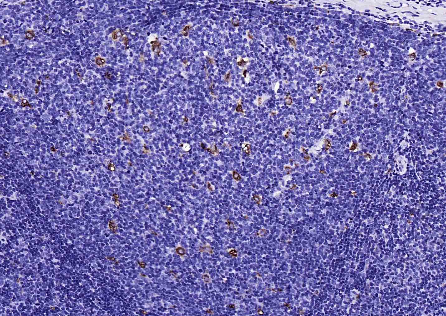 CD68 Rabbit pAb (一抗) - IHC-P,IHC-F,IF | Bioss