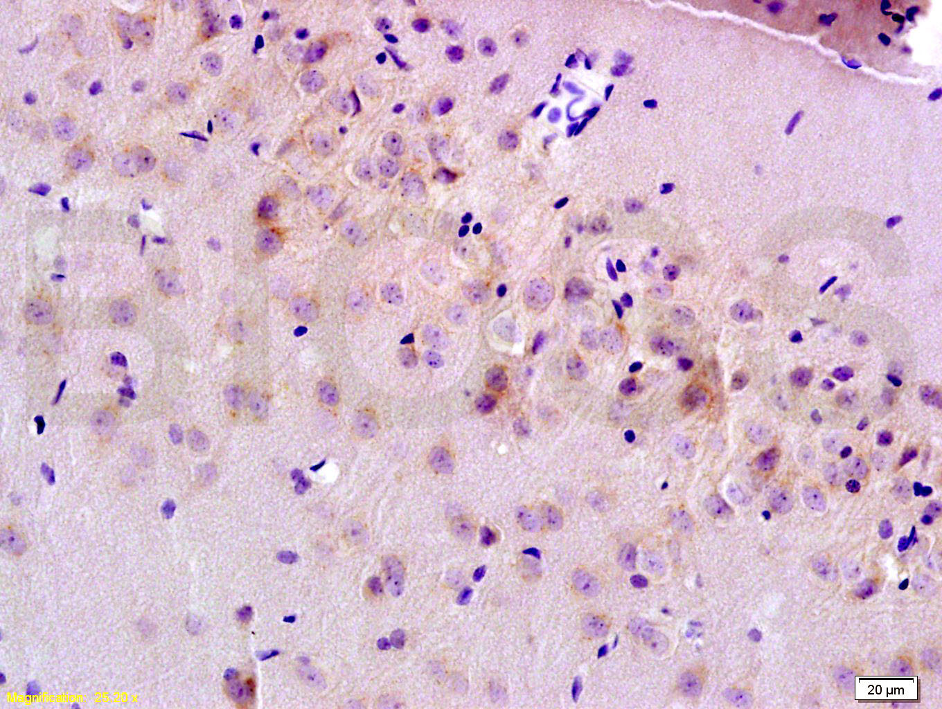 多药耐药相关蛋白1抗体-bs-0657R