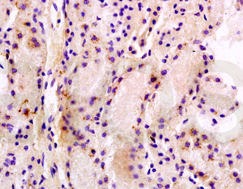 多药耐药相关蛋白1抗体-bs-0657R