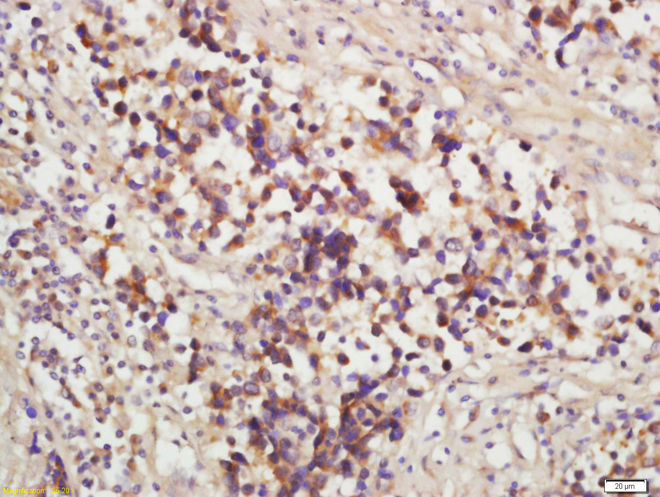 多药耐药相关蛋白1抗体-bs-0657R