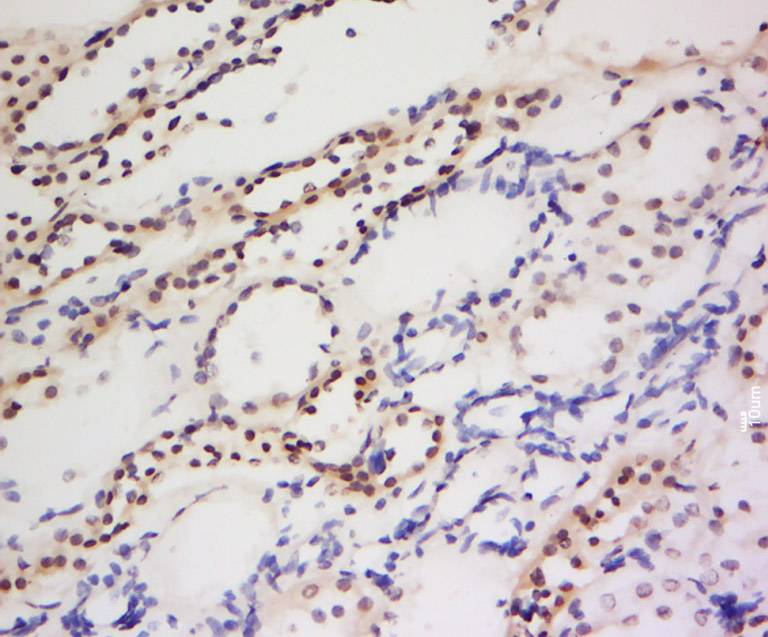 PIWIL1 Rabbit pAb (一抗) | Bioss